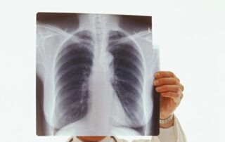 Lung x-ray being held up tot he light by doctor