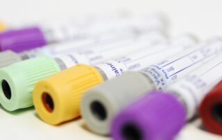 blood test tubes