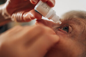 Senior adult carefully applying eye drops to her eye