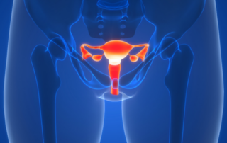 Colorized medical illustration of the female pelvic organs: uterus with fallopian tubes and ovaries.