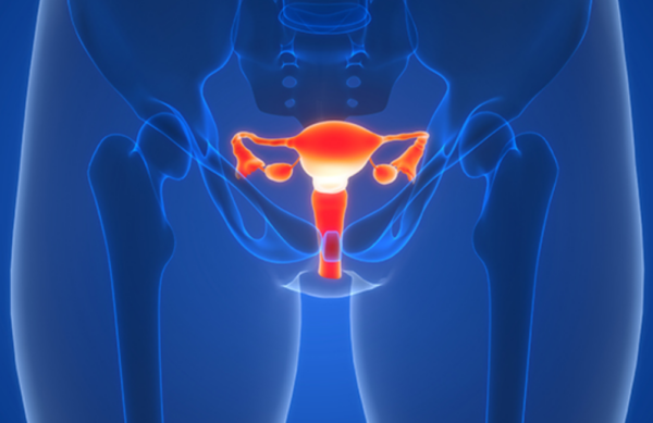 Colorized medical illustration of the female pelvic organs: uterus with fallopian tubes and ovaries.